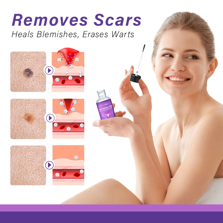 Oveallgo™ AraneaCare Skin Tag Remover