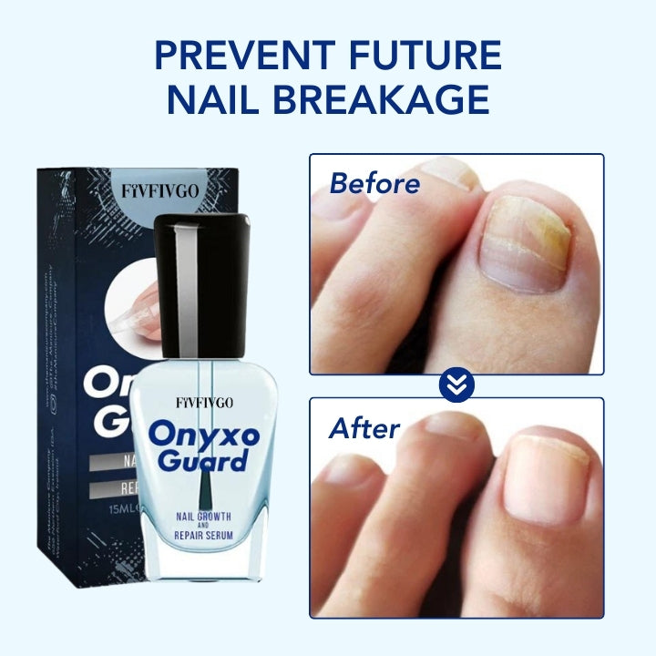 Fivfivgo™ OnyxoGuard Nail Growth and Repair Serum
