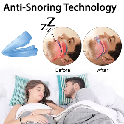 Fivfivgo™ Anti-Snoring and Anti-Grinding Teeth Protector